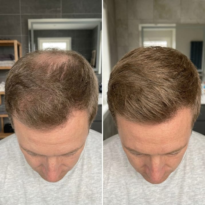Korean Scalp Revival Bar - OliviaSkin